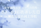 【ヒゲ脱毛レビュー17回目】6Jだけどザギンクオリティに感服＠湘南美容外科銀座院